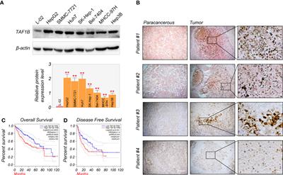 TAF1B depletion leads to apoptotic cell death by inducing nucleolar stress and activating p53-miR-101 circuit in hepatocellular carcinoma